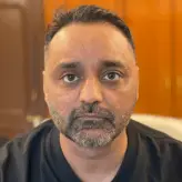 threadlift-face